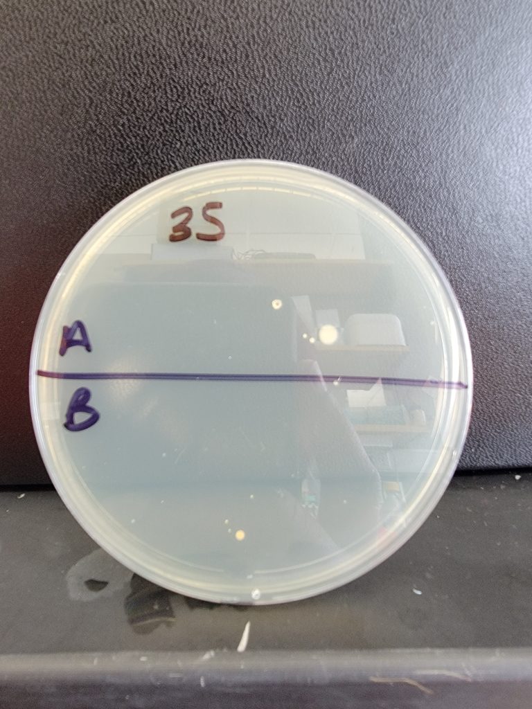 Petri Dish 35
