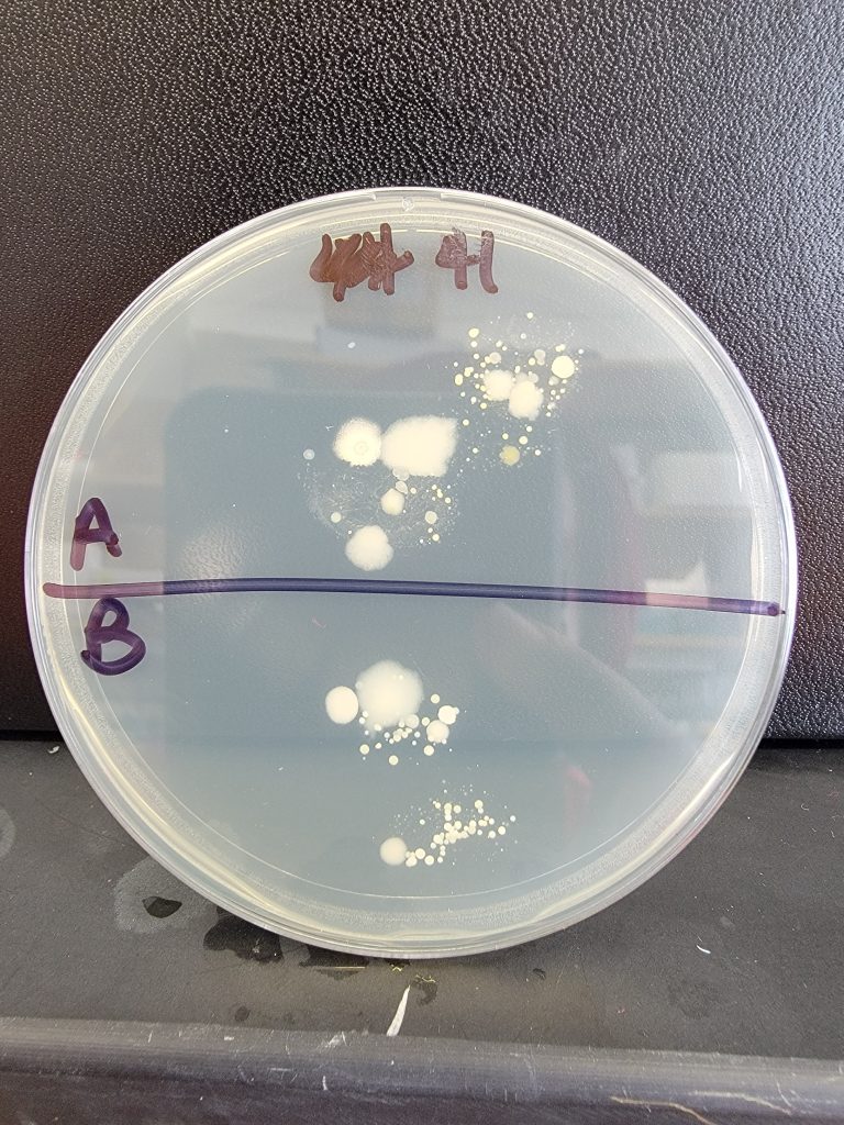 Petri Dish 41