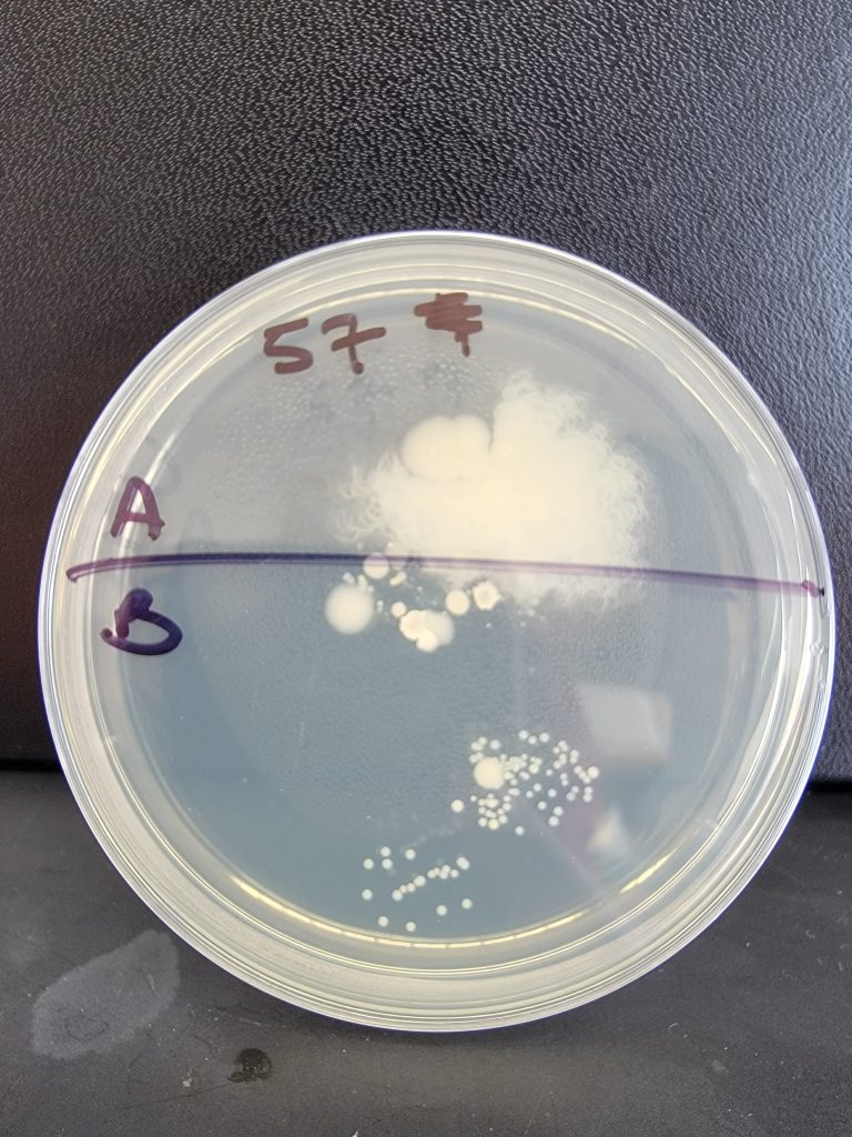 Petri Dish 57