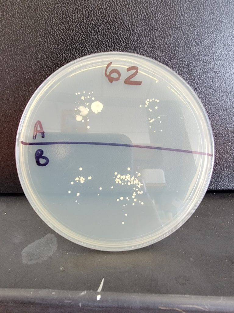 Petri Dish 62