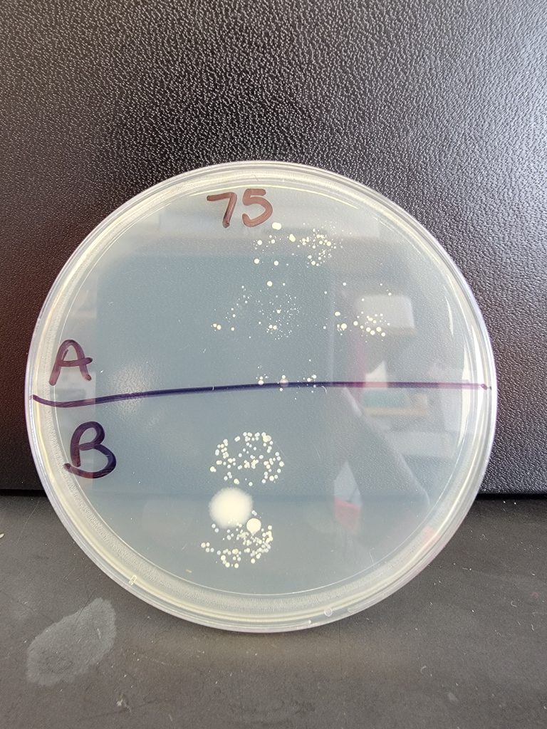 Petri Dish 75