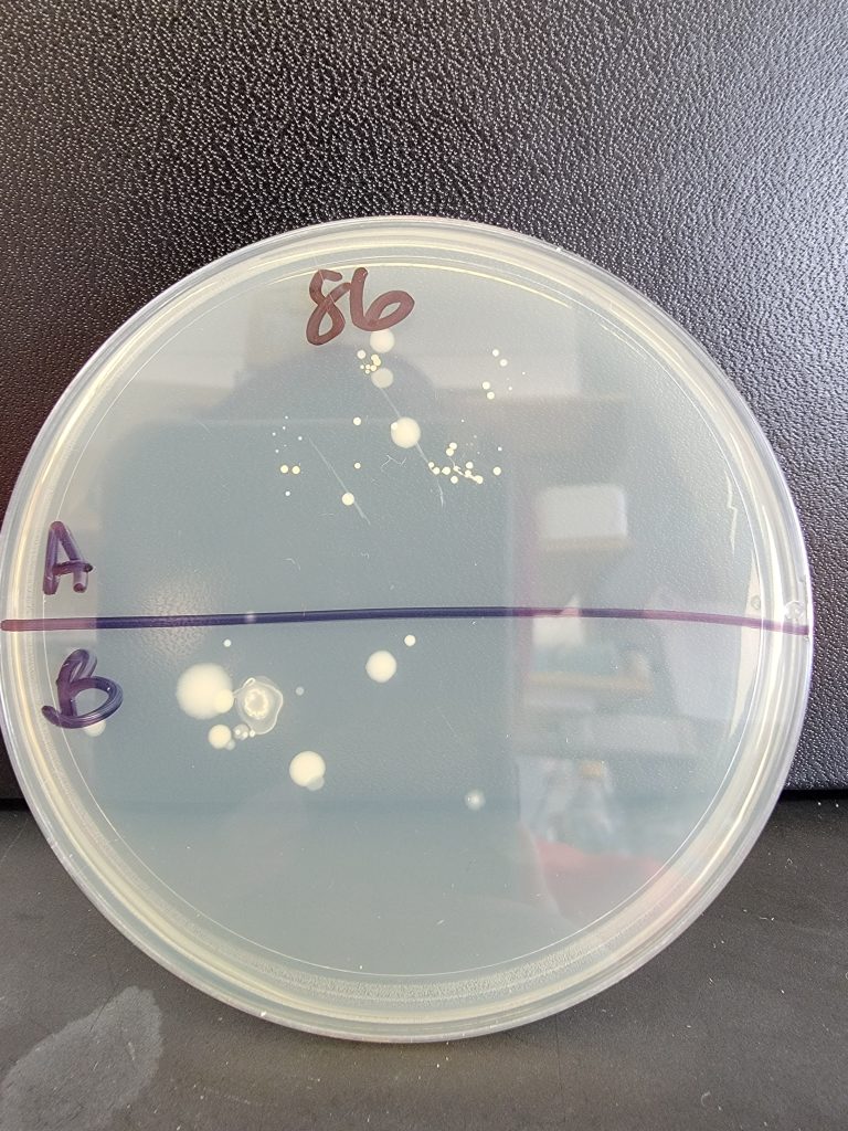 Petri Dish 86