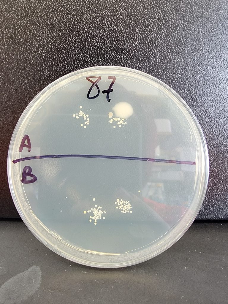 Petri Dish 87